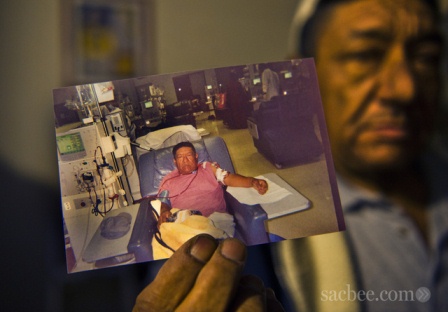 Ignacio dialysis